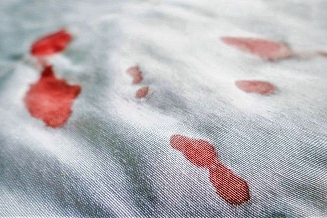Rimuovere macchie di sangue: un trucco infallibile